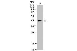 WB Image Sample(30 ug whole cell lysate) A:293T 12% SDS PAGE antibody diluted at 1:500 (Biglycan Antikörper)