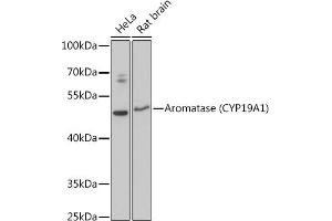Western blot analysis of extracts of various cell lines, using Aromatase (CYP19) antibody (2684) at 1:3000 dilution. (Aromatase Antikörper  (AA 1-180))