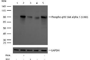 All lanes : Phospho-p90 S6K alpha 1 (S380) Rabbit mAb at 1/1k dilution Lane 1 : Hela whole cell lysates Lane 2 : Hela treated with 200nM PMA for 30 min whole cell lysates Lane 3 :Hela treated with 100 ng/mL EGF for 20 min whole cell lysates Lane 4 : JK whole cell lysates Lane 5 : JK treated with 200nM PMA for 30 min whole cell lysates Lysates/proteins at 20 μg per lane. (Rekombinanter RPS6KA1 Antikörper  (pSer380))