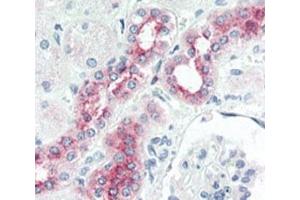 Immunohistochemistry (IHC) image for anti-Bone Morphogenetic Protein Receptor, Type II (serine/threonine Kinase) (BMPR2) (AA 28-59) antibody (ABIN3030192)