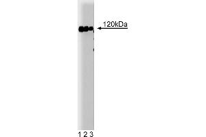 Western Blotting (WB) image for anti-Cas-Br-M (Murine) Ecotropic Retroviral Transforming Sequence (CBL) (AA 595-810) antibody (ABIN967971)