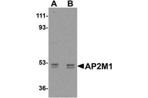 Western Blotting (WB) image for anti-Adaptor-Related Protein Complex 2, mu 1 Subunit (AP2M1) (C-Term) antibody (ABIN1030240) (AP2M1 Antikörper  (C-Term))