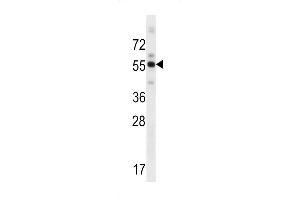 Western blot analysis in human placenta tissue lysates (35ug/lane). (ZBTB8B Antikörper  (C-Term))