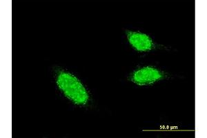 Immunofluorescence of monoclonal antibody to BLID on HeLa cell. (BLID Antikörper  (AA 2-108))