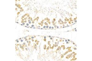 Immunohistochemistry analysis of paraffin-embedded rat testis using Torsin A (ABIN7075942) at dilution of 1: 800 (TOR1A Antikörper)