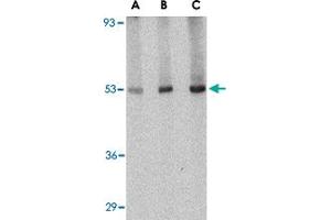 Western blot analysis of CRLF2 in human liver tissue lysate with CRLF2 polyclonal antibody  at (A) 0. (CRLF2 Antikörper  (Internal Region))