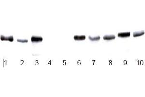 Image no. 4 for anti-Glyceraldehyde-3-Phosphate Dehydrogenase (GAPDH) antibody (ABIN284439) (GAPDH Antikörper)