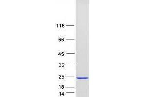 Validation with Western Blot (SNCA Protein (Transcript Variant 2) (Myc-DYKDDDDK Tag))