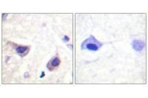 Immunohistochemistry analysis of paraffin-embedded human brain tissue using JAK3 (Ab-785) antiobdy.