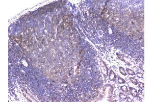 IHC analysis of PPID using anti-PPID antibody (ABIN6719438).
