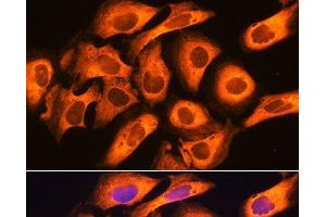 Immunofluorescence analysis of U20S cells using RIG-I / DDX58 Polyclonal Antibody at dilution of 1:100. (DDX58 Antikörper)