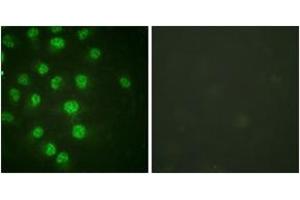 Immunofluorescence (IF) image for anti-Cyclin-Dependent Kinase Inhibitor 1C (p57, Kip2) (CDKN1C) (AA 267-316), (pThr310) antibody (ABIN1531619)