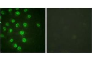 Immunofluorescence analysis of HuvEc cells treated with serum 20% 30', using p57 Kip2 (Phospho-Thr310) Antibody. (CDKN1C Antikörper  (pThr310))