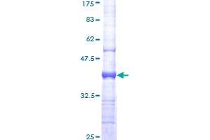 Image no. 1 for Plasminogen Activator, Urokinase Receptor (PLAUR) (AA 25-134) protein (GST tag) (ABIN2565084)