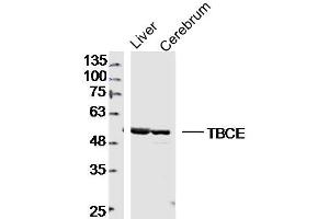 Lane 1: mouse iver lysates Lane 2: mouse cererum lysates probed with TBCE Polyclonal Antibody, Unconjugated  at 1:300 dilution and 4˚C overnight incubation. (TBCE Antikörper  (AA 1-100))