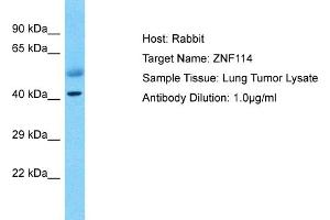 Host: Rabbit Target Name: ZNF114 Sample Type: Lung Tumor lysates Antibody Dilution: 1. (ZNF114 Antikörper  (C-Term))