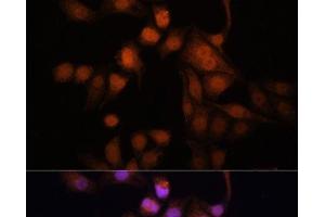 Immunofluorescence analysis of HeLa cells using Twist Polyclonal Antibody at dilution of 1:100. (TWIST1 Antikörper)