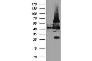 Western Blotting (WB) image for anti-Leucine Rich Repeat Containing 25 (LRRC25) antibody (ABIN1499199)