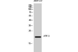 Western Blot analysis of 293T-UV cells using ATF-3 Polyclonal Antibody diluted at 1:500. (ATF3 Antikörper  (AA 100-180))