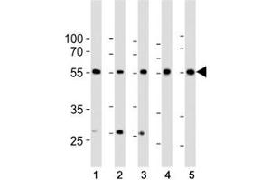 Western blot analysis of lysate from 1) HeLa, 2) K562, 3) MCF-7 cell line, 4) human liver and 5) mouse liver tissue lysate using BMPR1A antibody at 1:1000. (BMPR1A Antikörper  (AA 1-30))