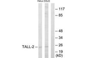 Western blot analysis of extracts from HeLa/COLO205 cells, using TALL-2 Antibody. (TNFSF13 Antikörper  (AA 151-200))