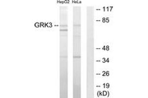 Western blot analysis of extracts from HepG2/HeLa cells, using GRK3 Antibody. (ADRBK2 Antikörper  (AA 361-410))