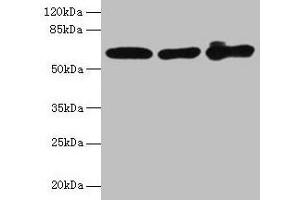 Western blot All lanes: KRT6A antibody at 4 μg/mL Lane 1: A431 whole cell lysate Lane 2: K562 whole cell lysate Lane 3: MCF-7 whole cell lysate Secondary Goat polyclonal to rabbit IgG at 1/10000 dilution Predicted band size: 61 kDa Observed band size: 61 kDa (KRT6A Antikörper  (AA 2-564))