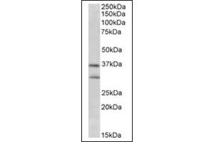 Image no. 1 for anti-Fibroblast Growth Factor 23 (FGF23) (Internal Region) antibody (ABIN375198) (FGF23 Antikörper  (Internal Region))