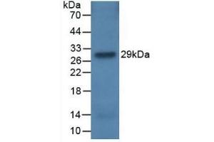 Detection of Recombinant CFH, Rat using Monoclonal Antibody to Complement Factor H (CFH) (Complement Factor H Antikörper  (AA 975-1217))
