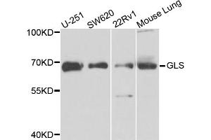 Western blot analysis of extracts of various cell lines, using GLS antibody. (Glutaminase Antikörper)