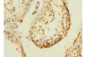 Immunohistochemistry of paraffin-embedded human testis tissue using ABIN7166755 at dilution of 1:100 (DHX32 Antikörper  (AA 301-500))