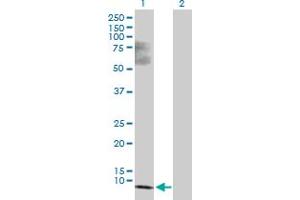 Western Blot analysis of SS18L2 expression in transfected 293T cell line by SS18L2 MaxPab polyclonal antibody. (SS18L2 Antikörper  (AA 1-77))