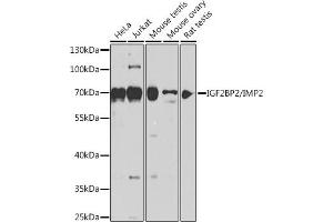 Western blot analysis of extracts of various cell lines, using IGF2BP2/IMP2 antibody (ABIN6134718, ABIN6142241, ABIN6142243 and ABIN6218347) at 1:1000 dilution. (IGF2BP2 Antikörper  (C-Term))