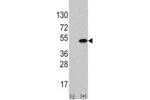 Western blot analysis of ATF4 antibody and 293 cell lysate (2 ug/lane) either nontransfected (Lane 1) or transiently transfected with the ATF4 gene (2). (ATF4 Antikörper  (AA 220-252))