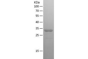 Western Blotting (WB) image for Collagen, Type VI, alpha 1 (COL6A1) (AA 728-1028) protein (His tag) (ABIN7122447) (COL6A1 Protein (AA 728-1028) (His tag))