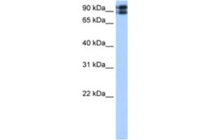 Western Blotting (WB) image for anti-C2CD2-Like (C2CD2L) antibody (ABIN2463042) (C2CD2L Antikörper)