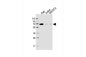 Lane 1: Raji, Lane 2: Jurkat, Lane 3: NIH/3T3 cell lysate at 20 µg per lane, probed with bsm-51381M RELB (1684CT450. (RELB Antikörper)