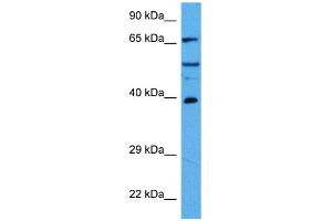 Host:  Rabbit  Target Name:  HDAC2  Sample Tissue:  Mouse Pancreas  Antibody Dilution:  1ug/ml (HDAC2 Antikörper  (C-Term))