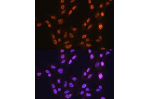 Immunofluorescence (IF) image for anti-CCCTC-Binding Factor (Zinc Finger Protein) (CTCF) antibody (ABIN7266164)