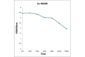 Antigen: 2 µg/100 µL  Primary: Antiserum, 1:500, 1:1000, 1:2000, 1:4000, 1:8000, 1:16000, 1:32000;  Secondary: HRP conjugated Rabbit Anti-Goat IgG at 1: 5000;  TMB staining Read the data in Microplate Reader by 450nm. (STIP1 Antikörper)