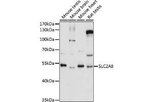 Western blot analysis of extracts of various cell lines, using SLC2 antibody (ABIN7270412) at 1:1000 dilution. (SLC2A8 Antikörper  (AA 200-260))