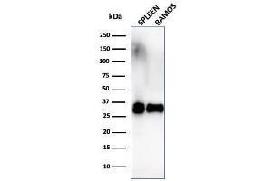 Western Blot Analysis of Ramos cells and human spleen tissue lysate using HLA-DR Monoclonal Antibody (SPM289). (HLA-DR Antikörper)