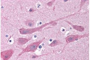 Human Brain, Cortex: Formalin-Fixed, Paraffin-Embedded (FFPE) (GABRB1 Antikörper  (AA 1-226))