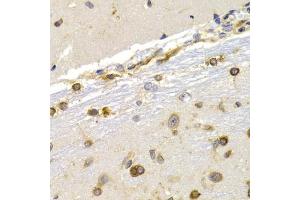 Immunohistochemistry of paraffin-embedded rat brain using EEF1D antibody (ABIN3023318, ABIN3023319, ABIN3023320 and ABIN6219589) at dilution of 1:200 (40x lens). (EEF1D Antikörper  (AA 1-160))