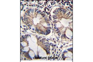 ME2 Antibody (C-term) (ABIN656541 and ABIN2845805) immunohistochemistry analysis in formalin fixed and paraffin embedded human rectum tissue followed by peroxidase conjugation of the secondary antibody and DAB staining. (NAD-ME Antikörper  (C-Term))