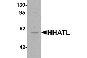 Western blot analysis of HHATL in 3T3 cell lysate with HHATL antibody at 1 µg/mL.