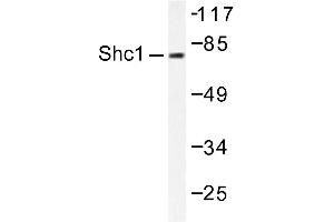 Image no. 2 for anti-SHC (Src Homology 2 Domain Containing) Transforming Protein 1 (SHC1) antibody (ABIN271910) (SHC1 Antikörper)