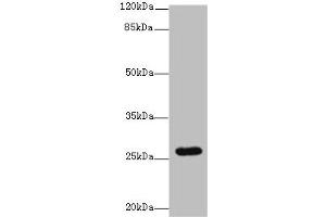 Western blot All lanes: TMEM217 antibody at 10 μg/mL + Jurkat whole cell lysate Secondary Goat polyclonal to rabbit IgG at 1/10000 dilution Predicted band size: 27, 25 kDa Observed band size: 27 kDa (TMEM217 Antikörper  (AA 150-211))