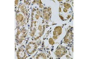Immunohistochemistry (Paraffin-embedded Sections) (IHC (p)) image for anti-Cyclin A2 (CCNA2) (AA 1-200) antibody (ABIN1679040)