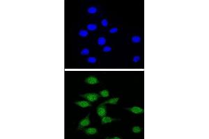 Confocal immunofluorescent analysis of AIRE Antibody (Center) with 293 cell followed by Alexa Fluor® 488-conjugated goat anti-rabbit lgG (green). (AIRE Antikörper  (Middle Region))